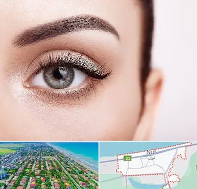 فوق تخصص عنبیه در نور
