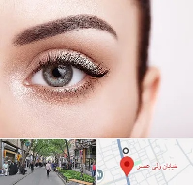 فوق تخصص عنبیه در ولیعصر شهریار