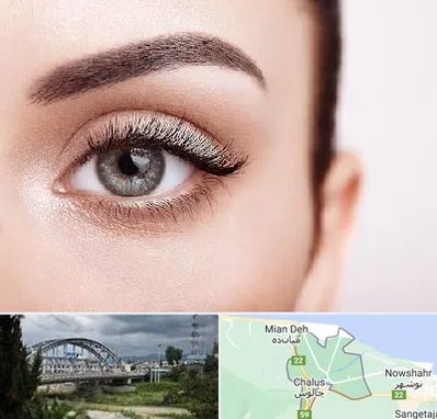 فوق تخصص عنبیه در چالوس