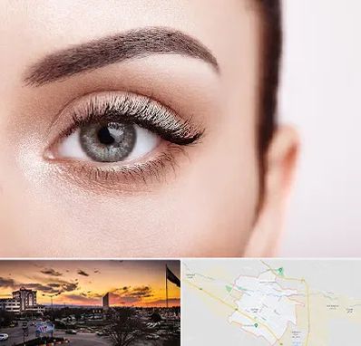 فوق تخصص عنبیه در قوچان