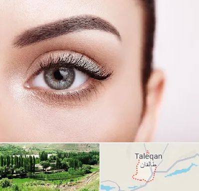فوق تخصص عنبیه در طالقان
