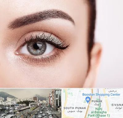 فوق تخصص عنبیه در پونک 