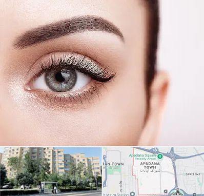 فوق تخصص عنبیه در آپادانا