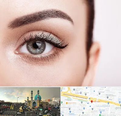 فوق تخصص عنبیه در رسالت 