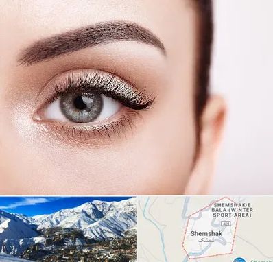 فوق تخصص عنبیه در شمشک