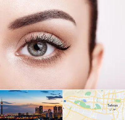 فوق تخصص عنبیه در غرب تهران 