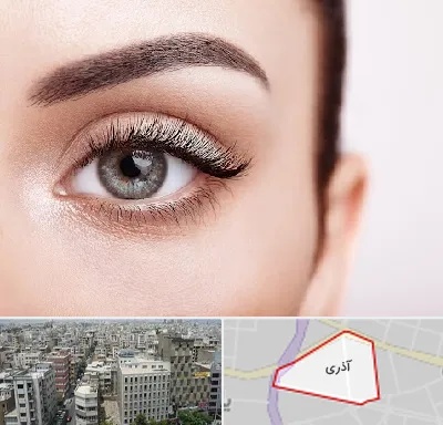 فوق تخصص عنبیه در آذری