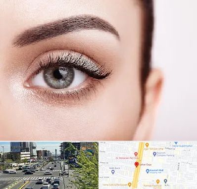 فوق تخصص عنبیه در ستاری 