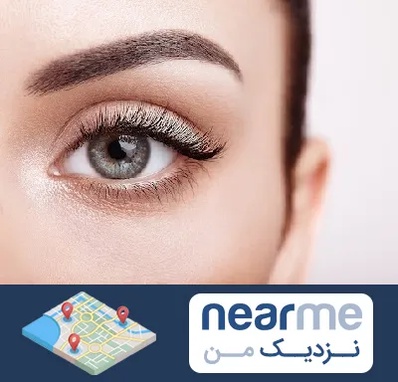 فوق تخصص عنبیه در نزدیک من