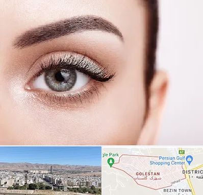 فوق تخصص عنبیه در شهرک گلستان شیراز