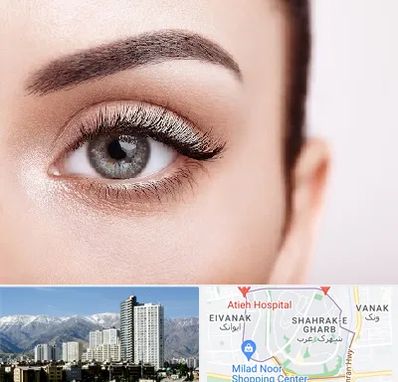 فوق تخصص عنبیه در شهرک غرب 