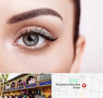 فوق تخصص عنبیه در 15 خرداد