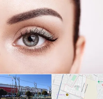 فوق تخصص عنبیه در فاز دو اندیشه