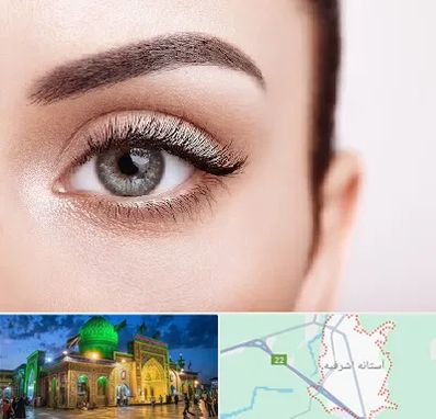 فوق تخصص عنبیه در آستانه اشرفیه