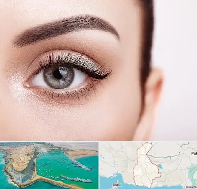 فوق تخصص عنبیه در سیستان و بلوچستان