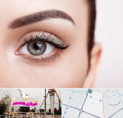 فوق تخصص عنبیه در پادادشهر اهواز