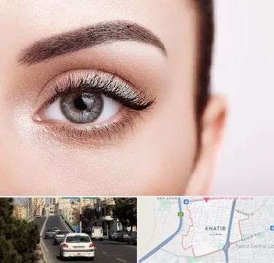 فوق تخصص عنبیه در خطیب تبریز