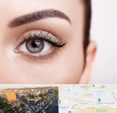 فوق تخصص عنبیه در تهرانپارس 