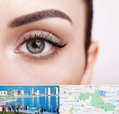 فوق تخصص عنبیه در چیتگر 