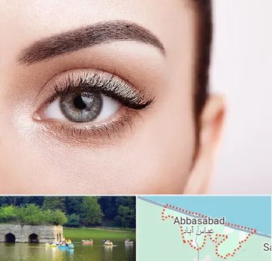 فوق تخصص عنبیه در عباس آباد