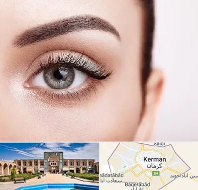 فوق تخصص عنبیه در کرمان