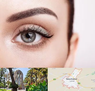 فوق تخصص عنبیه در نیشابور