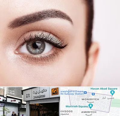 فوق تخصص عنبیه در منیریه 