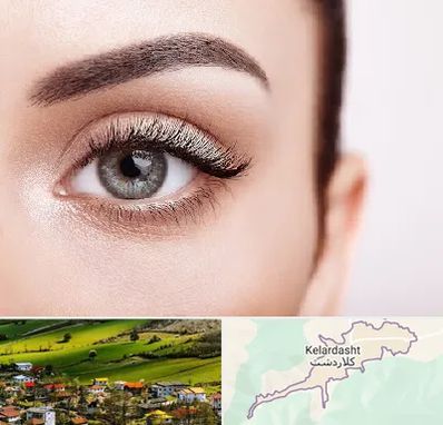 فوق تخصص عنبیه در کلاردشت
