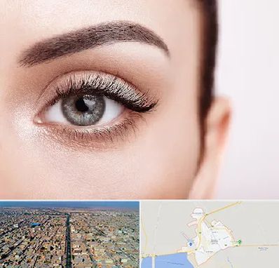 فوق تخصص عنبیه در بندر ماهشهر