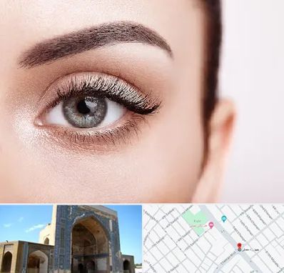 فوق تخصص عنبیه در مصلی مشهد