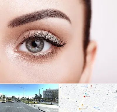 فوق تخصص عنبیه در بلوار کلاهدوز مشهد 