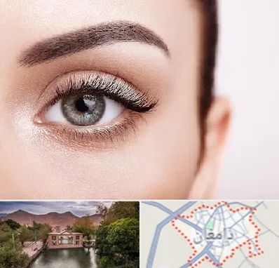 فوق تخصص عنبیه در دامغان