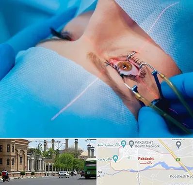 عمل prk چشم در پاکدشت