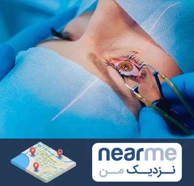 عمل prk چشم در نزدیک من