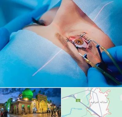 عمل prk چشم در آستانه اشرفیه