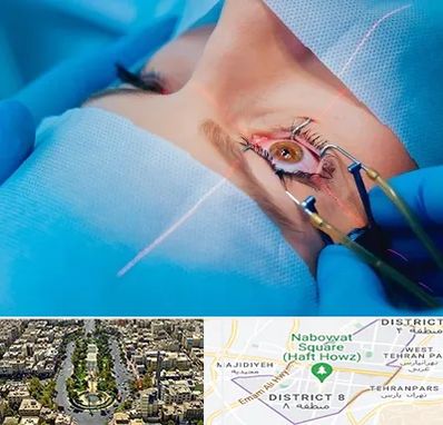 عمل prk چشم در نارمک 