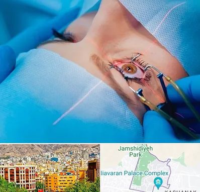 عمل prk چشم در نیاوران 