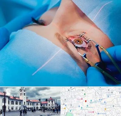 عمل prk چشم در میدان شهرداری رشت