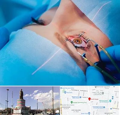 عمل prk چشم در کارگر جنوبی 