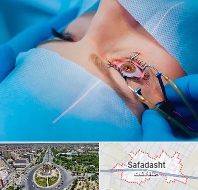 عمل prk چشم در صفادشت