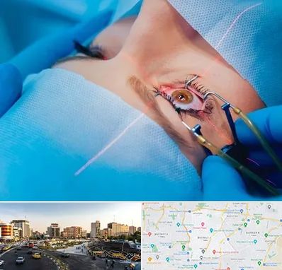 عمل prk چشم در منطقه 7 تهران 