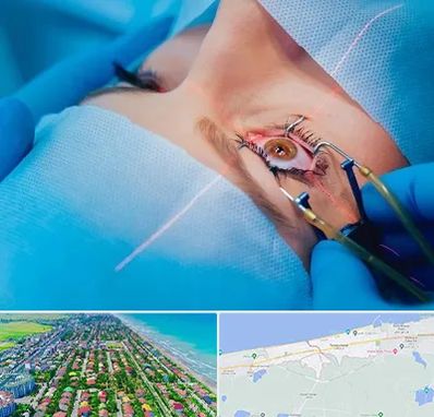 عمل prk چشم در فریدونکنار