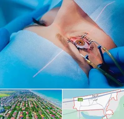 عمل prk چشم در نور