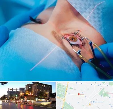 عمل prk چشم در بلوار سجاد مشهد 