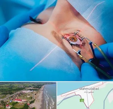 عمل prk چشم در محمودآباد