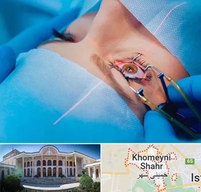 عمل prk چشم در خمینی شهر