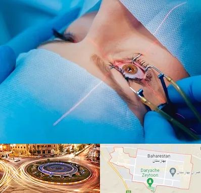 عمل prk چشم در بهارستان