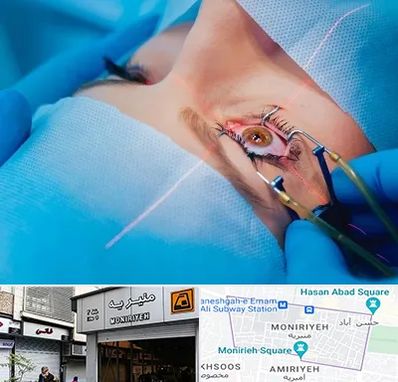 عمل prk چشم در منیریه 