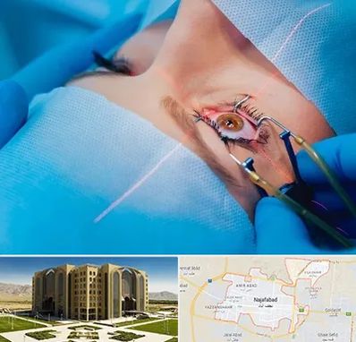 عمل prk چشم در نجف آباد
