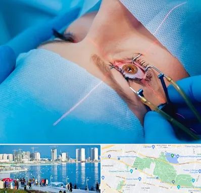 عمل prk چشم در چیتگر 